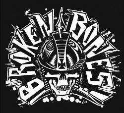 Broken Bones : Bones Club : The Very Best Of